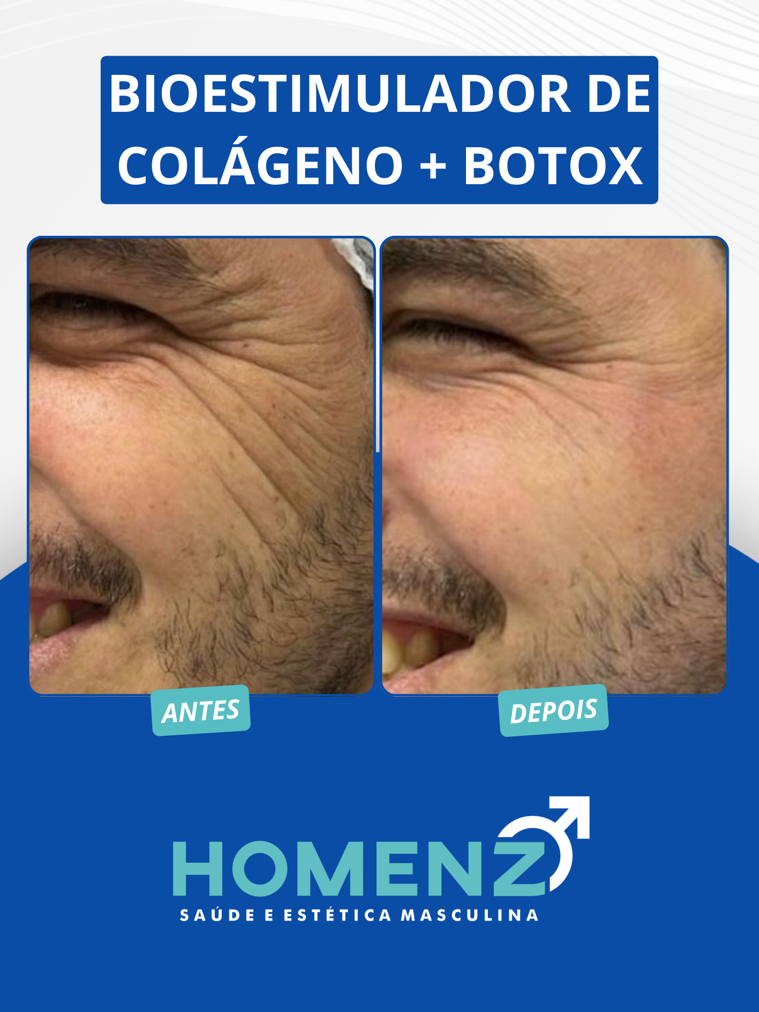FACIAL